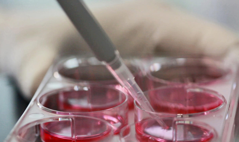 В Японии официально разрешены клинические испытания по лечению кератоконуса стволовыми клетками