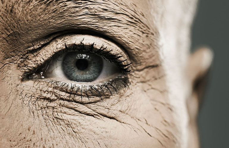 По глазным капиллярам можно выявить болезнь Альцгеймера на ранней стадии